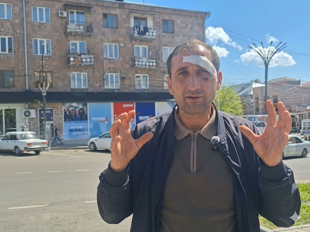 ՔՊ-ն խմբակներ է ձևավորում ընդդիմադիր ակտիվիստներին չեզոքացնելու համար. Արթիկում ծեծված բնակիչ