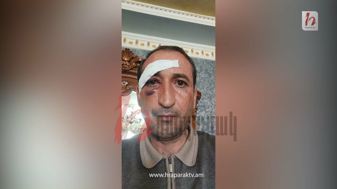 Քոչարյանի աջակցի ծեծի միջադեպով ոչ մեկին մեղադրանք չի առաջադրվել. «Հրապարակ»