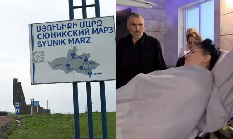 Ադրբեջանցու կրակոցից տուժած կինը վիրահատվել է, հետվիրահատական վիճակը կայուն է. ԱՆ